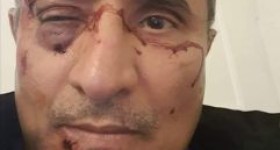اثار الاعتداء على د. الريوي