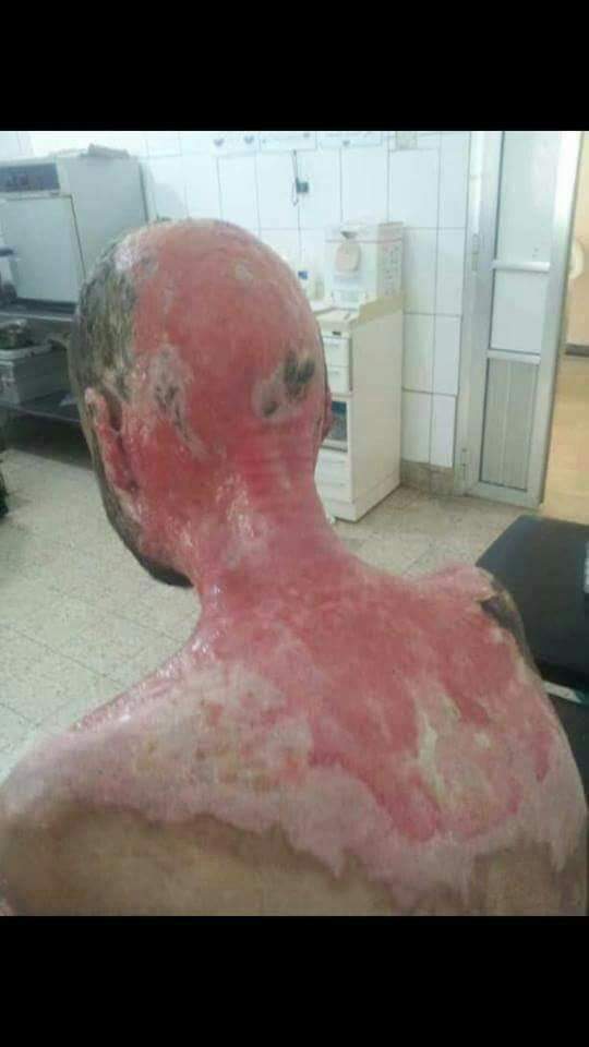 المعتقل الشرقي